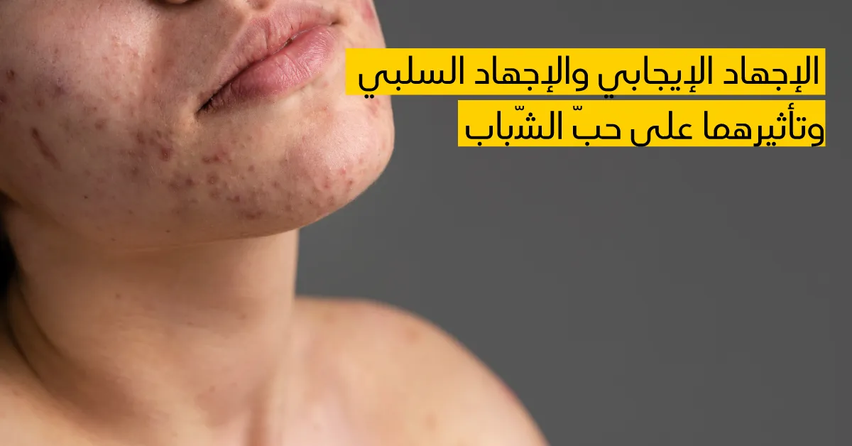 الإجهاد الإيجابي والإجهاد السلبي وتأثيرهما على حبّ الشّباب